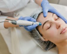 Mezoterapia mikroigłowa – skuteczne odmładzanie